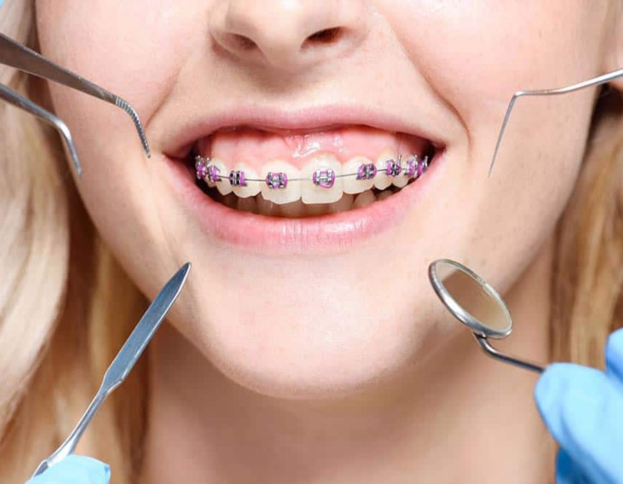 orthodontic treatment