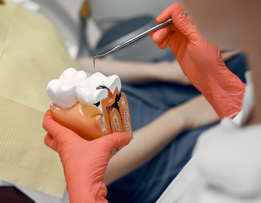 root canal treatment